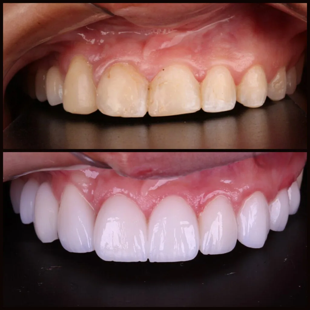 Sorriso transformado — Billig Odontologia