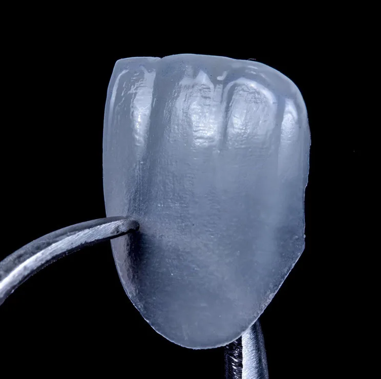 Lente de contato dental em Brasília — Billig Odontologia Asa Norte
